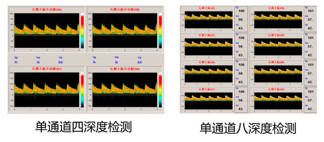 KJ-2V6M單通道八深度圖.jpg